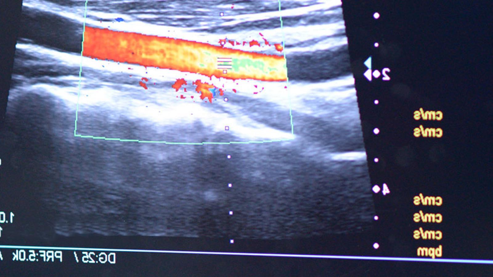 Vascular and Endovascular Surgery